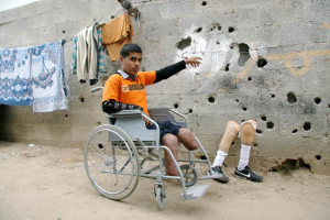 Ghassan Mattar, a Palestinian boy, who lost his legs during an Israeli attack…. Marked for life
